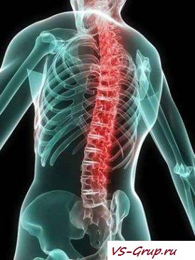 Причины риска. Вывихи позвоночника