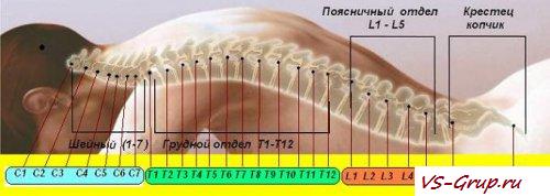 Причины риска. Вывихи позвоночника