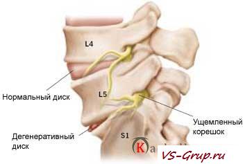 Предпосылки травм позвоночника