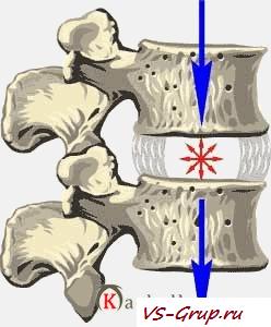 Позвоночник